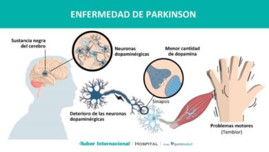Photo of Conozca las principales señales de alarma, para detectar la Enfermedad de Parkinson